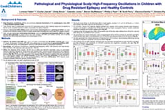 Pathological and physiological scalp high-frequency oscillations in children with drug resistant epilepsy and healthy controls