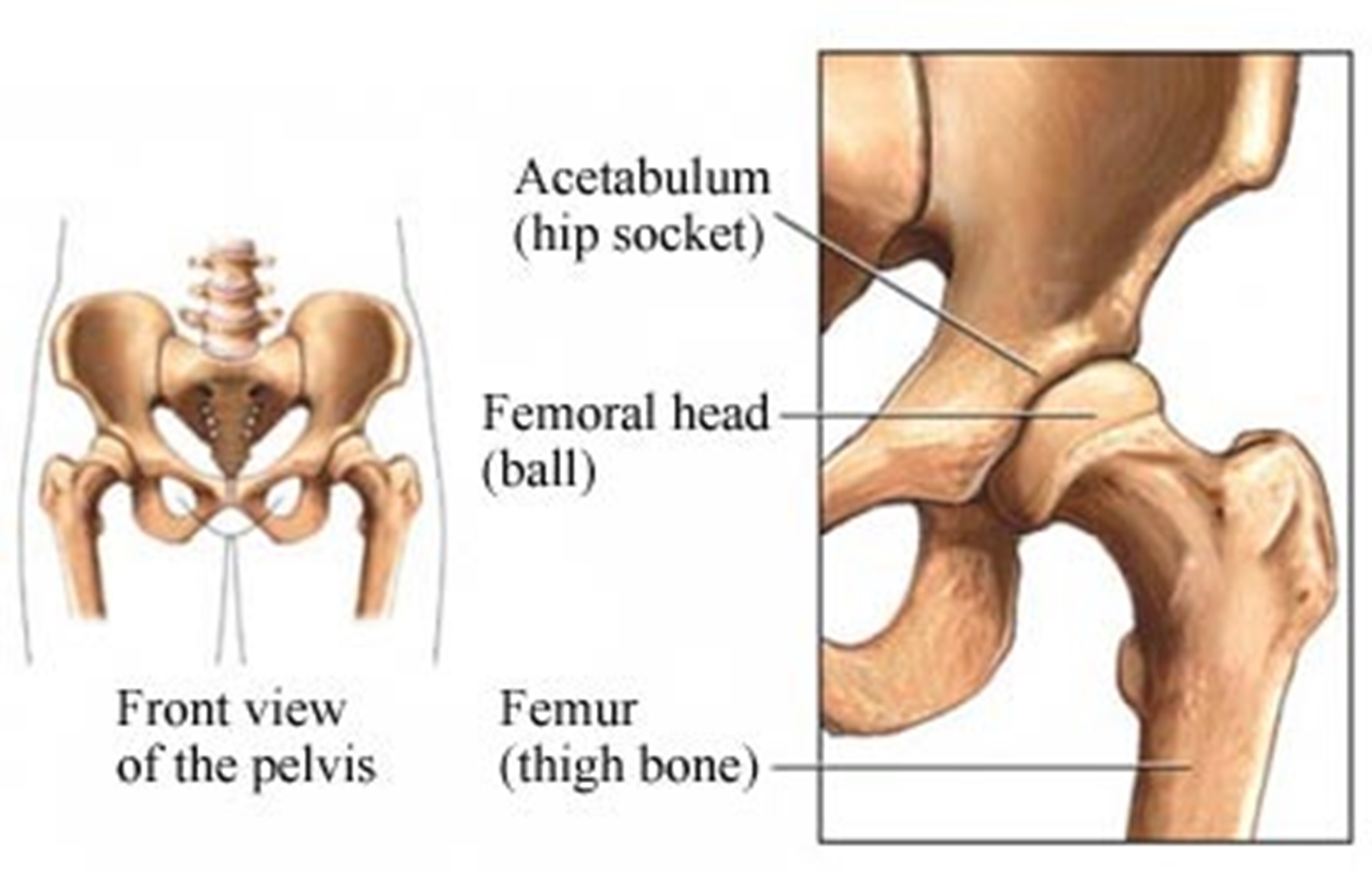 Hip Dislocation